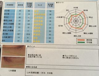 意外な盲点！日焼け対策で忘れがちな、あの場所とは？